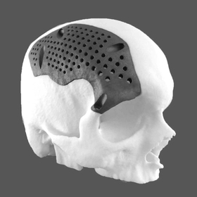 Cranial implant